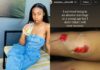 Singer Jelly Babie shares pictures of abuse by her husband